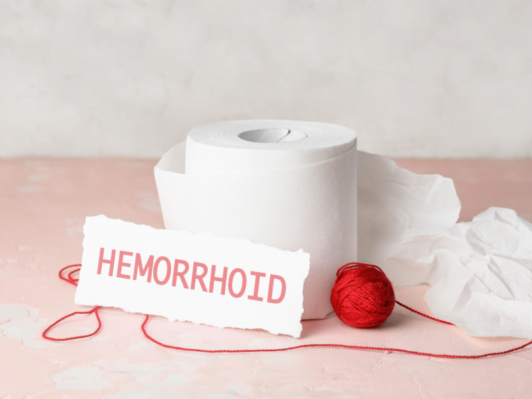 Can You Die From Hemorrhoids, Are Hemorrhoids Life Thretening if Untreated