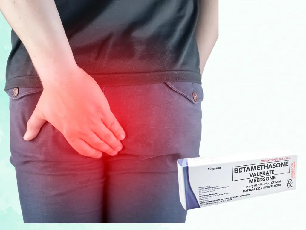 Man holding his bum from pain from hemorrhoids and itching and a box of Betamethasone cream for hemorrhoids
