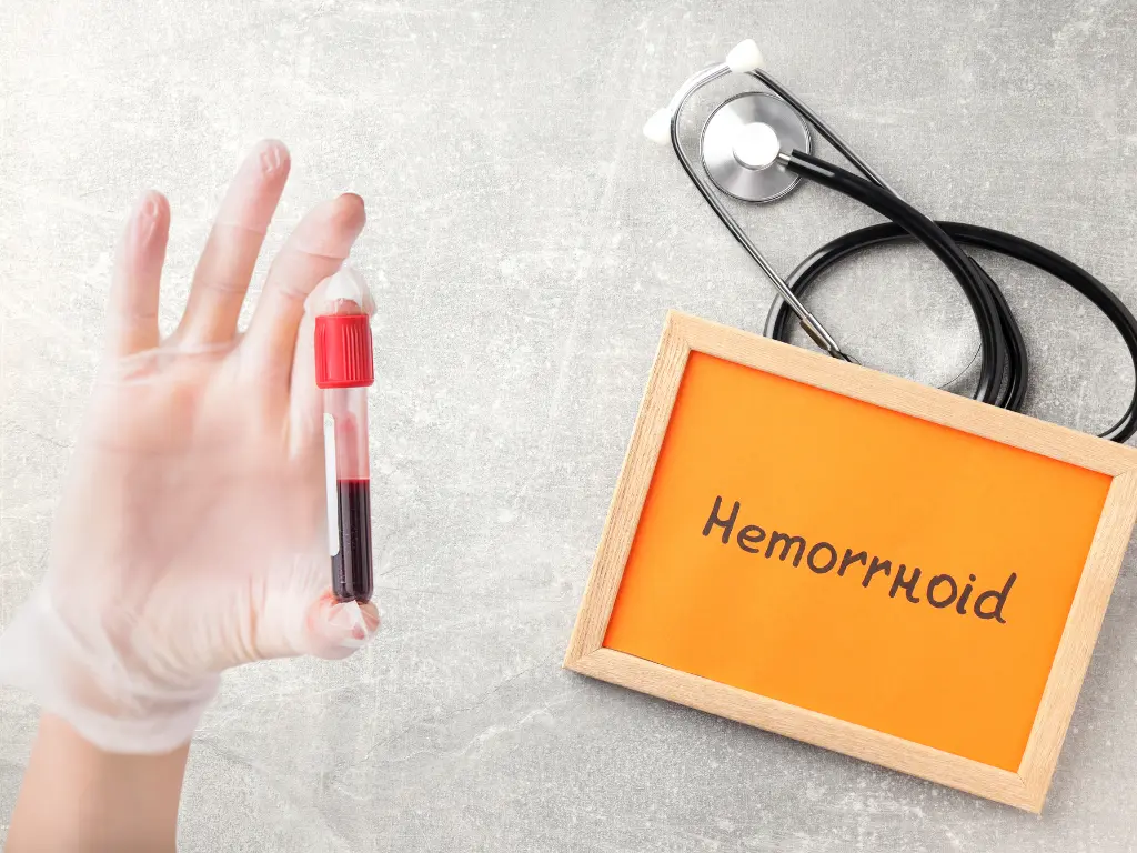 Haemorrhoid writes on a wooden board with doctors Stethoscope, and a sample of blood from Cologuard Test.
